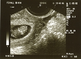 Ultrasounds